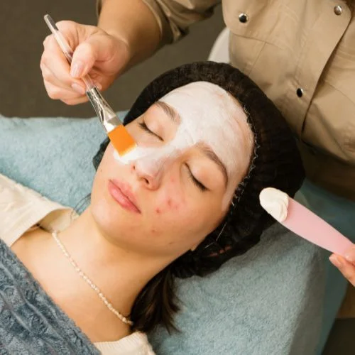 Acne cleaning facial Acne Cleaning Facial - Image 1